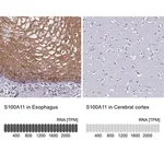 Merck Anti-S100A11 antibody produced in rabbit
