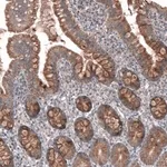 Merck Anti-FASTKD1 antibody produced in rabbit