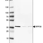 Merck Anti-RPP38 antibody produced in rabbit