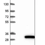Merck Anti-PPCDC antibody produced in rabbit