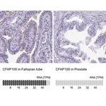 Merck Anti-CFAP100 antibody produced in rabbit