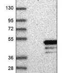 Merck Anti-MAGEB18 antibody produced in rabbit
