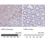 Merck Anti-CTRC antibody produced in rabbit