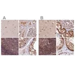 Merck Anti-NSFL1C antibody produced in rabbit