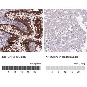 Merck Anti-KRTCAP3 antibody produced in rabbit
