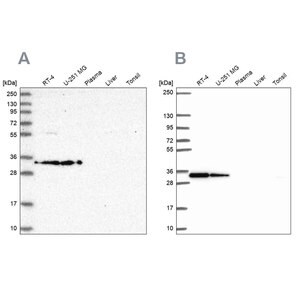 Merck Anti-RPS3A antibody produced in rabbit