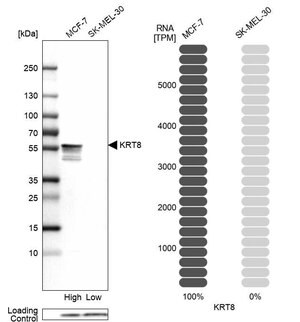 Merck Anti-KRT8 antibody produced in rabbit