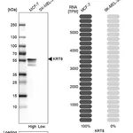 Merck Anti-KRT8 antibody produced in rabbit
