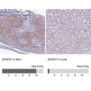 Merck Anti-DHX37 antibody produced in rabbit