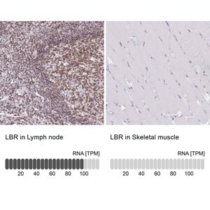 Merck Anti-LBR antibody produced in rabbit