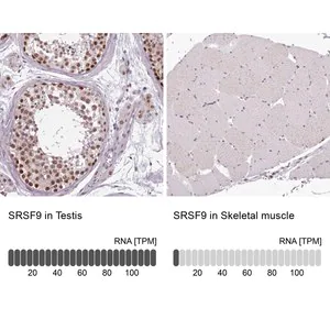 Merck Anti-SRSF9 antibody produced in rabbit