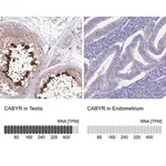 Merck Anti-CABYR antibody produced in rabbit