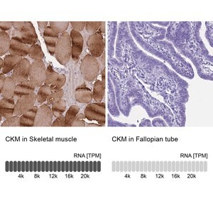 Merck Anti-CKM antibody produced in rabbit
