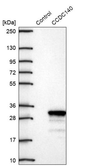 Merck Anti-CCDC140 antibody produced in rabbit