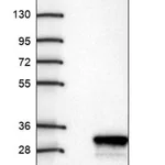 Merck Anti-CCDC140 antibody produced in rabbit