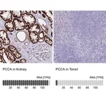 Merck Anti-PCCA antibody produced in rabbit