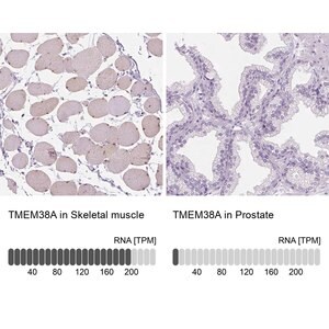 Merck Anti-TMEM38A antibody produced in rabbit