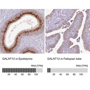 Merck Anti-GALNT12 antibody produced in rabbit