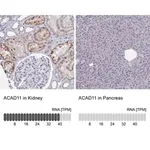 Merck Anti-ACAD11 antibody produced in rabbit