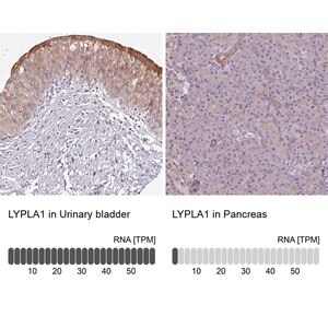 Merck Anti-LYPLA1 antibody produced in rabbit