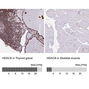 Merck Anti-HDAC8 antibody produced in rabbit