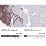 Merck Anti-HDAC8 antibody produced in rabbit