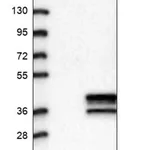 Merck Anti-ST3GAL3 antibody produced in rabbit