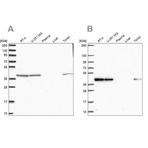 Merck Anti-IDH3B antibody produced in rabbit