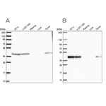 Merck Anti-IDH3B antibody produced in rabbit