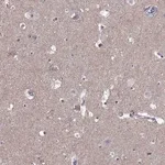 Merck Anti-ASIC2 antibody produced in rabbit