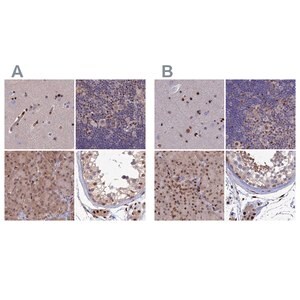 Merck Anti-DNPEP antibody produced in rabbit