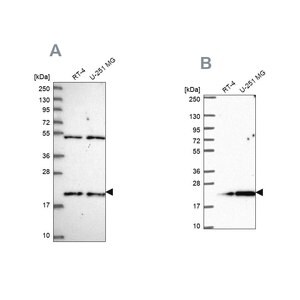 Merck Anti-KIAA1143 antibody produced in rabbit
