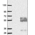 Merck Anti-MFSD8 antibody produced in rabbit