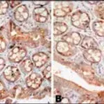 Merck Anti-FUS (internal) antibody produced in rabbit
