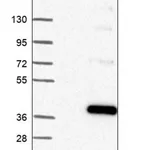 Merck Anti-RHBDD2 antibody produced in rabbit