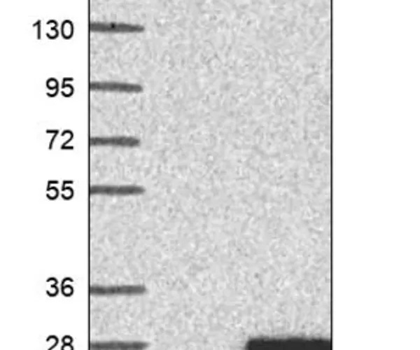 Merck Anti-TIMM22 antibody produced in rabbit