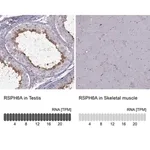 Merck Anti-RSPH6A antibody produced in rabbit