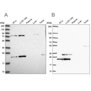 Merck Anti-EIF3K antibody produced in rabbit