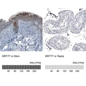 Merck Anti-KRT77 antibody produced in rabbit