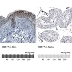 Merck Anti-KRT77 antibody produced in rabbit