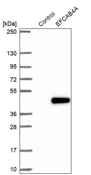 Merck Anti-CRACR2B antibody produced in rabbit