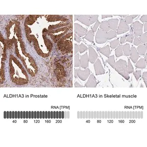 Merck Anti-ALDH1A3 antibody produced in rabbit
