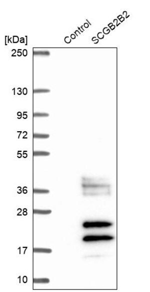 Merck Anti-SCGB2B2 antibody produced in rabbit