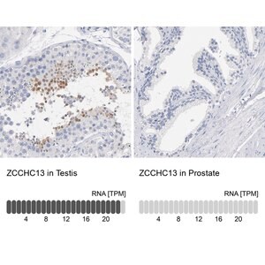 Merck Anti-ZCCHC13 antibody produced in rabbit