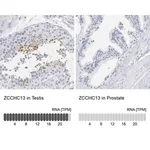 Merck Anti-ZCCHC13 antibody produced in rabbit
