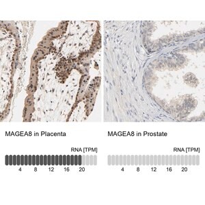 Merck Anti-MAGEA8 antibody produced in rabbit
