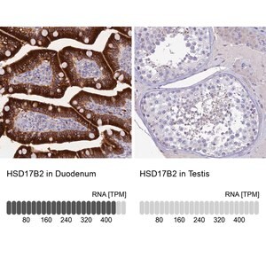 Merck Anti-HSD17B2 antibody produced in rabbit