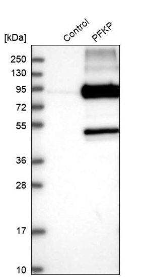 Merck Anti-PFKP antibody produced in rabbit