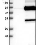Merck Anti-PFKP antibody produced in rabbit