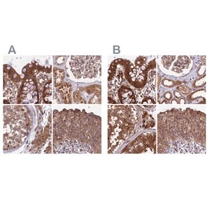 Merck Anti-MKKS antibody produced in rabbit